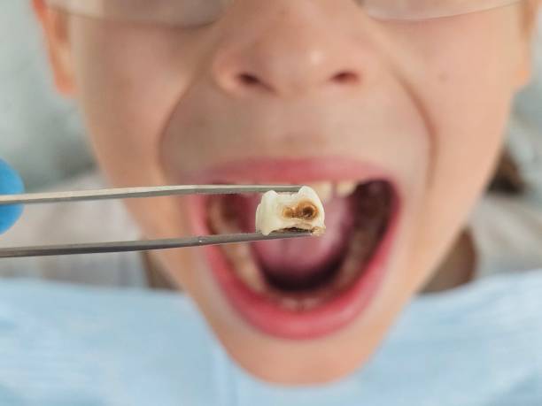 Best Emergency Gum Treatment in Harlan, IA